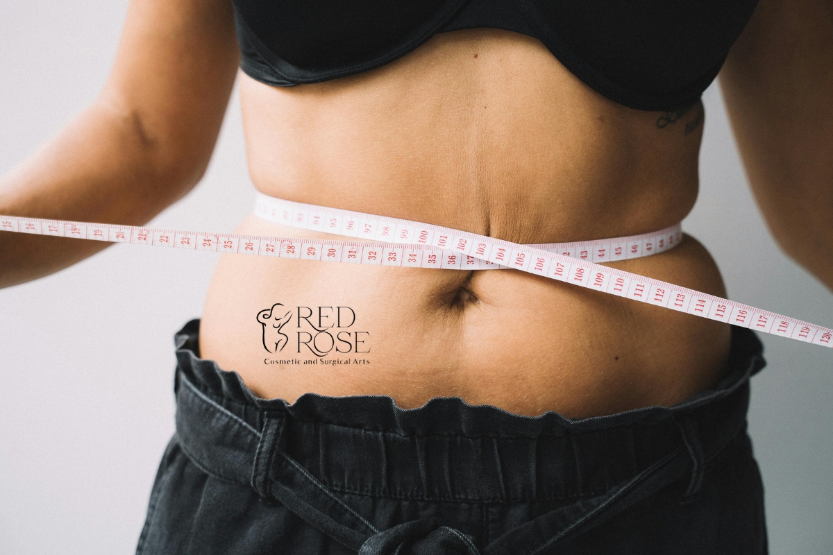 Tummy tuck Miami